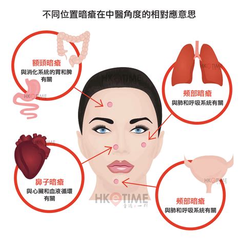 色氣 意思 額角暗瘡